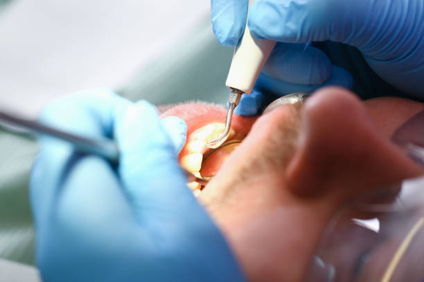 Best Emergency Denture Repair in Kiln, MS