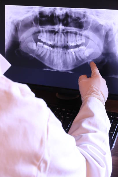 Best Emergency Gum Treatment in Kiln, MS