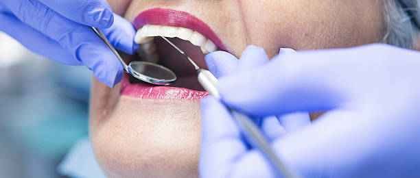 Best Emergency Dental Care for Broken or Chipped Teeth in Kiln, MS